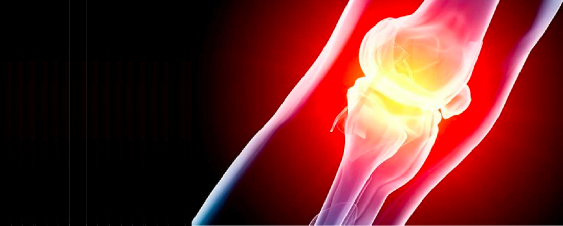 Fundacja Artretyzm publikuje pierwsze wytyczne dla pacjentów, którzy używają CBD do uśmierzania bólu